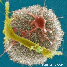 Bionic Eye Breakthrough: Tel Aviv University Pioneers Visionary Medicine