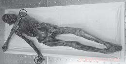 Nanostructural Study of 5,000-Year-Old Mummy Skin Uncovers Mummification Secrets