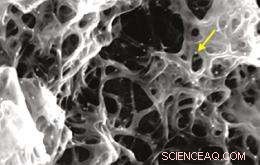 Yale Engineers Show Carbon Nanotubes Enhance T-Cell Cancer Immunity