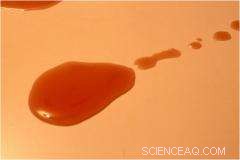 Tiny Coffee Rings Revolutionize Biosensor Sensitivity for Disease Detection