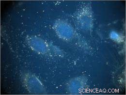 Gold Nanorods Deliver Potent Payload Against H1N1 and Other Flu Viruses