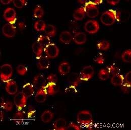 Transferrin-Targeted Nanoparticles and Humble Protein Collaborate to Eradicate Cancer Cells