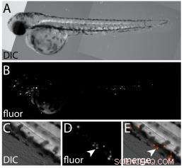 Scientists Deploy Plasmonic Nanobubbles to Detect & Eradicate Prostate Cancer Cells in Living Organisms – Video Inside