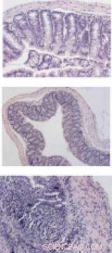 New Oral Thioketal Nanoparticle System Delivers siRNA to Inflammatory Bowel Disease Sites
