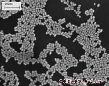 Gold Nanoparticles: A Novel Approach to Detect and Treat Cancer