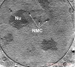 Cutting‑Edge Microscope Unveils Cellular Ultrastructure