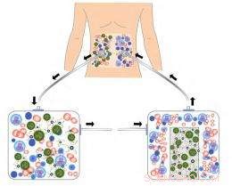 New Ovarian Cancer Treatment Approach Emerges from Recent Study