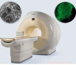 Tracking Neural Stem Cells with Magnetic Nanoparticles