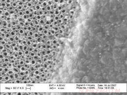 Nanomodified Surfaces Protect Leg Implants from Infection