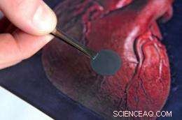 Researchers Develop Nanopatch to Repair Heart Damage