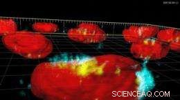 Targeting Tumors with Superparamagnetic Iron Oxide: Precision Cancer Therapy