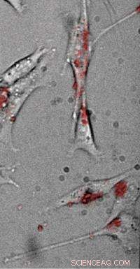 Nano-Thermometers Reveal First In-Cell Temperature Variations