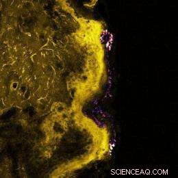 Advanced Laser Imaging Reveals Zinc Oxide Nanoparticles  Skin Safety in Sunscreens