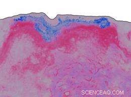 Advanced Laser Imaging Reveals Zinc Oxide Nanoparticles  Skin Safety in Sunscreens