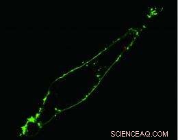 Nanophotonic Endoscope Enables Real-Time Optical Insight Inside Living Cells