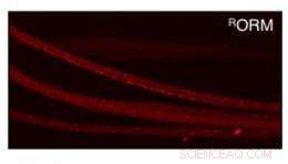 ORMOSIL Nanoparticles: A Promising Brain-Targeted Vehicle for Precise Drug Delivery