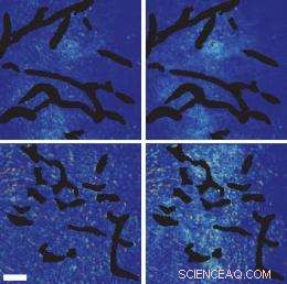 Tumor Blood Vessel Normalization Significantly Enhances Delivery of Ultra‑Small Nanomedicines