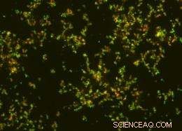 Innovative Nanoparticle Therapy Targets Drug-Resistant Bacteria