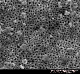 Ultrananocrystalline Diamond-Coated Membranes: A New Frontier in Medical Implants