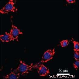 Fluorescent Dyes with Aggregation‑Induced Emission: Innovative Probes for Cancer Diagnosis and Therapy