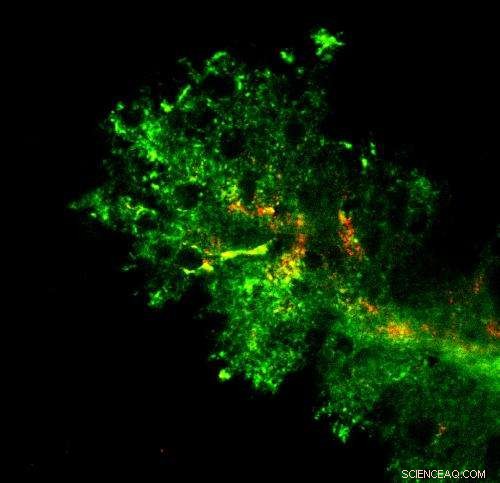 PEG Polymer Coating Enables Nanoparticles to Penetrate the Brain