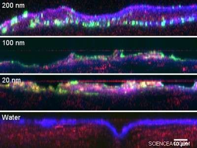 Study Finds Nanoparticles Do Not Penetrate Human Skin