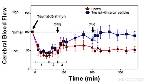 New Treatment Shows Promise for Reversing Traumatic Brain Injuries in Soldiers, Athletes, and Victims
