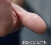 Nanoparticles Enhance Durability of Invisible Orthodontic Brackets