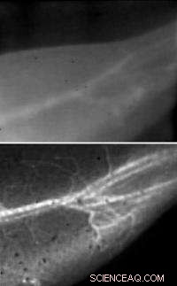 Stanford s Carbon‑Nanotube Laser Technique Enhances Blood Flow Imaging