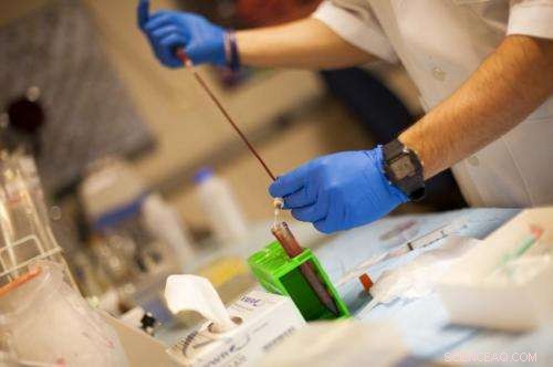 Nanoparticle Drug Carriers: Why They Get Trapped in Bloodstream