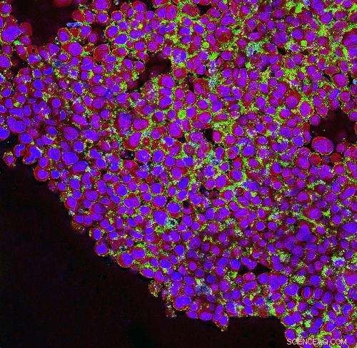 Nanomedicine: Targeted Drug Delivery at the Nanoscale Offers New Hope for Precise Treatments