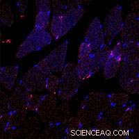 Breakthrough Biodegradable Nanoparticles Rapidly Resolve Inflammation, Scientists Report