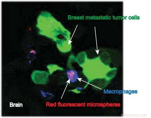 IU Surgeons Leverage Greek Mythology to Innovate Nanoparticle Cancer Therapy