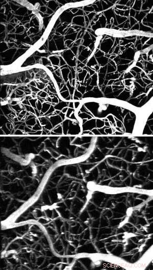 New Dye Cuts Costs for Two‑Photon Microscopy, Expanding Advanced Imaging