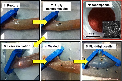 Revolutionary Laser Welding Material Enhances Intestinal Surgery Outcomes
