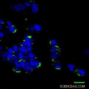 Hydrogel Breakthrough: Squishy Materials Reveal Nanoparticle Biological Effects