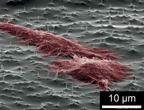 Nano-Needle Technology Forces Medication into Resistant Cells