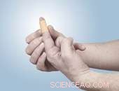 Innovative Bandage Inspired by Human Scabs Promises Faster Healing