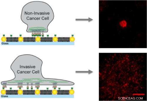 Groundbreaking Discovery: Biomechanical Forces Drive Cancer Metastasis