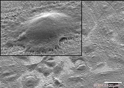 Innovative Coating Enhances Bone Integration for Joint Replacements