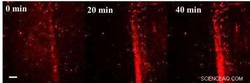Self-Powered Nanoparticles Deliver Targeted Bone‑Healing Drugs Directly to Fractures