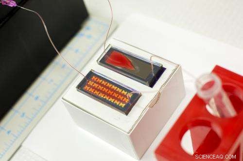 Liquid Biopsy: Advancing Cancer Diagnosis and Treatment