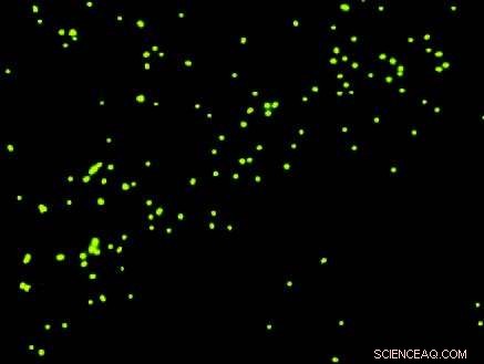 Liquid Biopsy: Advancing Cancer Diagnosis and Treatment