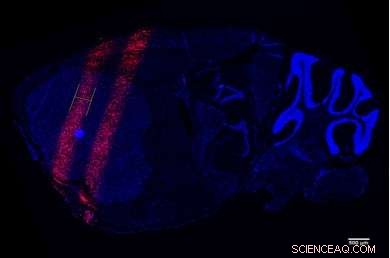 New Microbeam Emitter Paves Way for Clinical Adoption of Microbeam Radiation Therapy
