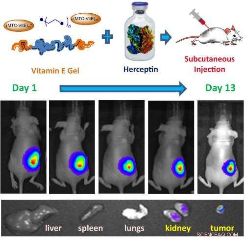New Hydrogel Accelerates Breast Cancer Tumor Shrinkage