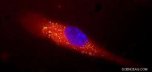 Nanosponge Vaccine Targets MRSA Toxins for Enhanced Antimicrobial Protection