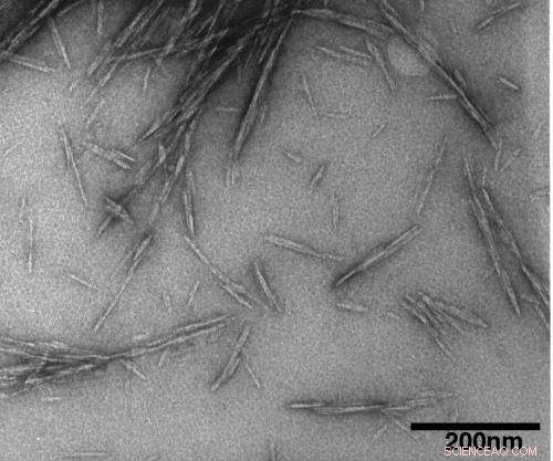 Cellulose Nanocrystals: The Next Green Wonder Material