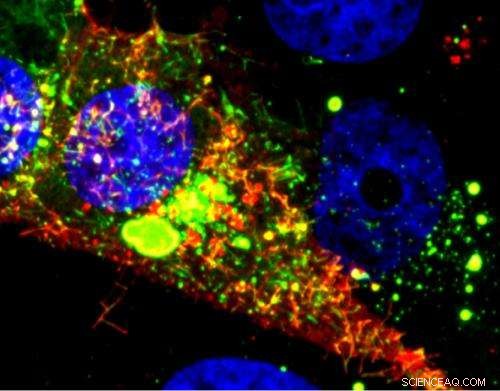 Advanced Imaging Unlocks Secrets of Childhood RSV