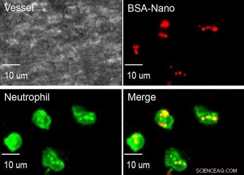 Targeted Delivery of Anti-Inflammatory Drugs via Nanoparticles