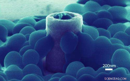 New Insight into Staphylococcus Adhesion on Nanostructures Could Revolutionize Infection Prevention